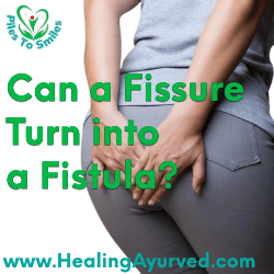 Anal fissure vs. anal fistula