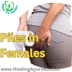 piles in females causes symptoms diagnosis and treatment