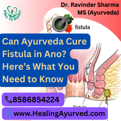 Ayurvedic Ksharsutra treatment for Fistula-in-Ano, a proven alternative to traditional surgery