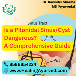 Pilonidal Sinus Cyst Symptoms and Risks